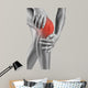 Acute pain in knee 