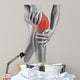Acute pain in knee 