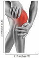 Acute pain in knee 