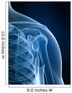 radiograph of the shoulder Wall Mural