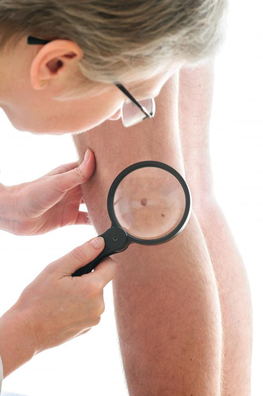 Dermatologist examines a mole Wall Mural