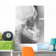 Radiographie dentaire Wall Mural