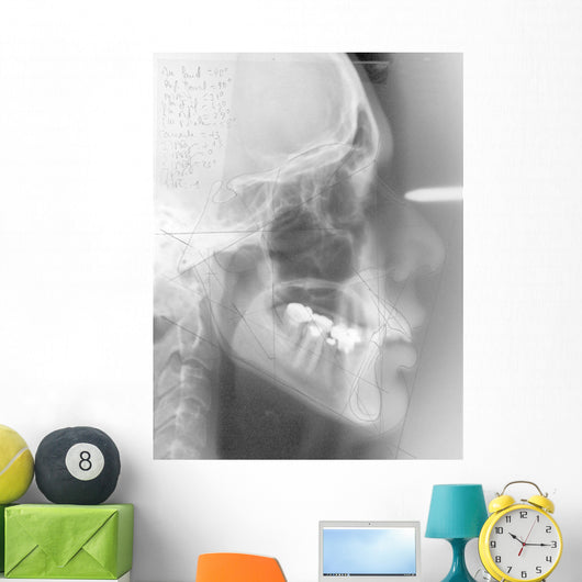 Radiographie dentaire Wall Mural