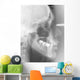 Radiographie dentaire Wall Mural