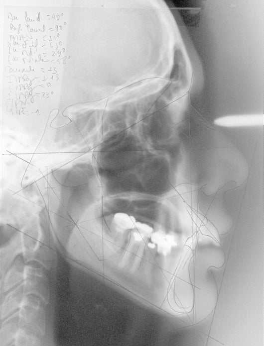 Radiographie dentaire Wall Mural