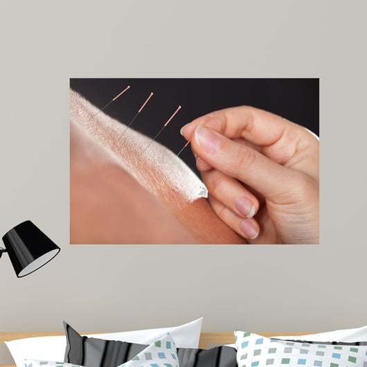 Man Getting Acupuncture Treatment 