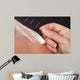 Man Getting Acupuncture Treatment 