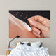 Man Getting Acupuncture Treatment 