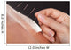 Man Getting Acupuncture Treatment 