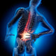 Back Pain 2 