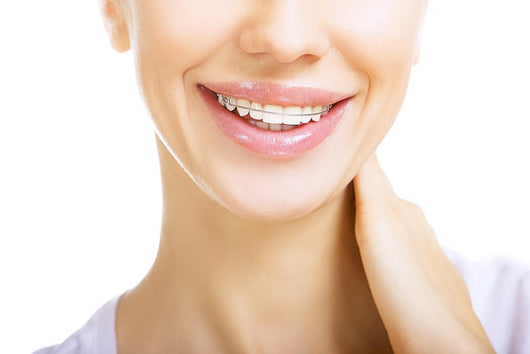 Beautiful smiling girl with retainer for teeth Wall Mural
