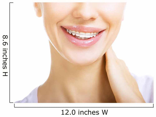 Beautiful smiling girl with retainer for teeth Wall Mural