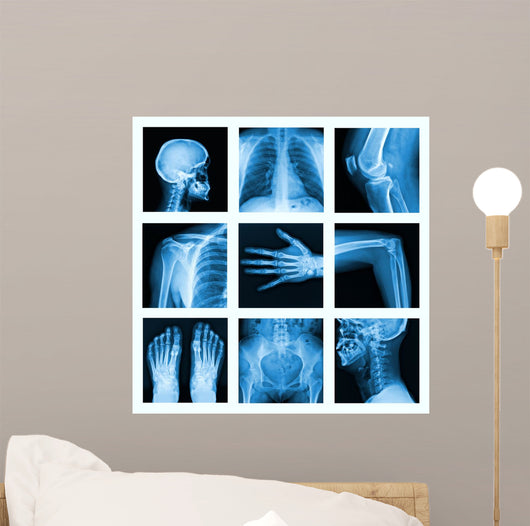 Collage of many X-rays in very good quality. 