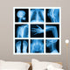 Collage of many X-rays in very good quality. 