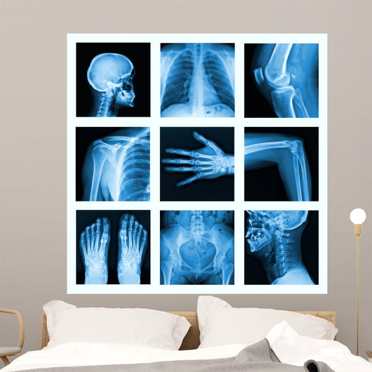 Collage of many X-rays in very good quality. 
