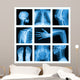 Collage of many X-rays in very good quality. 