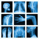 Collage of many X-rays in very good quality. 