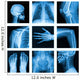 Collage of many X-rays in very good quality. 