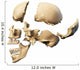 Human skull with parts exploded. 