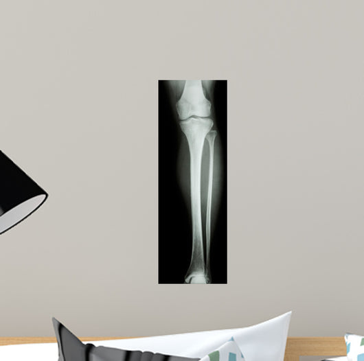 Film X-Ray Normal Humans Leg 