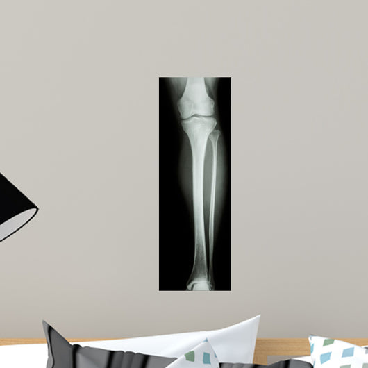 Film X-Ray Normal Humans Leg 