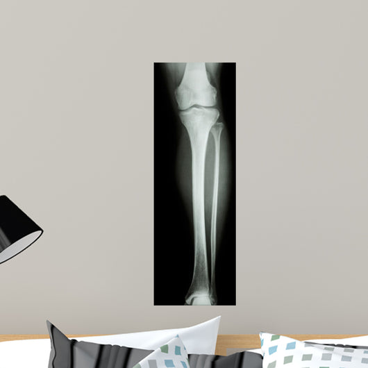 Film X-Ray Normal Humans Leg 