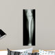 Film X-Ray Normal Humans Leg 