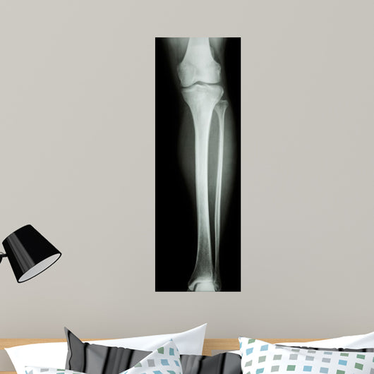 Film X-Ray Normal Humans Leg 