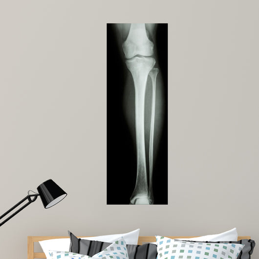 Film X-Ray Normal Humans Leg 