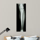 Film X-Ray Normal Humans Leg 