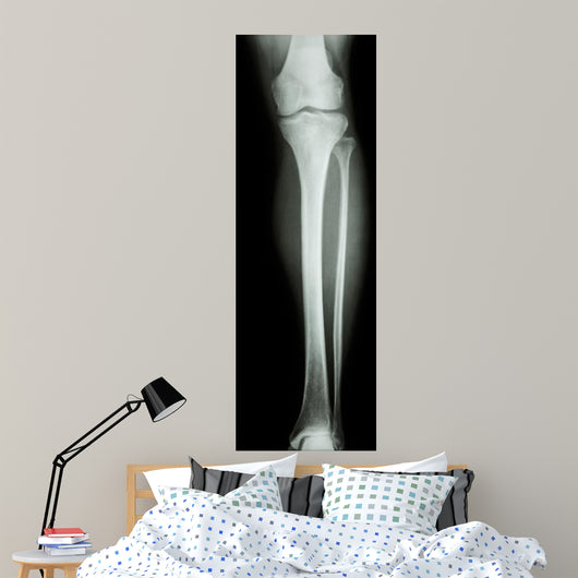 Film X-Ray Normal Humans Leg 