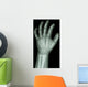X-Ray Infants Hand 