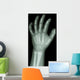 X-Ray Infants Hand 
