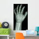 X-Ray Infants Hand 