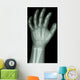 X-Ray Infants Hand 