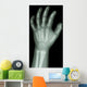 X-Ray Infants Hand 