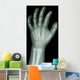 X-Ray Infants Hand 