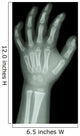 X-Ray Infants Hand 