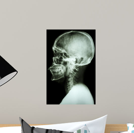 X-Ray Asian Skull and Cervical Spine 