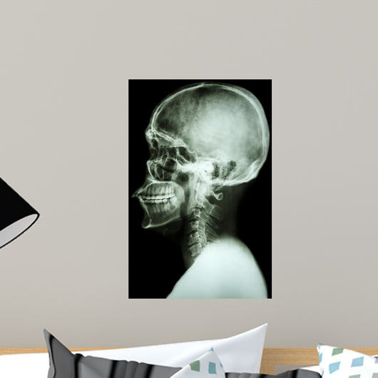 X-Ray Asian Skull and Cervical Spine 