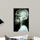 X-Ray Asian Skull and Cervical Spine 