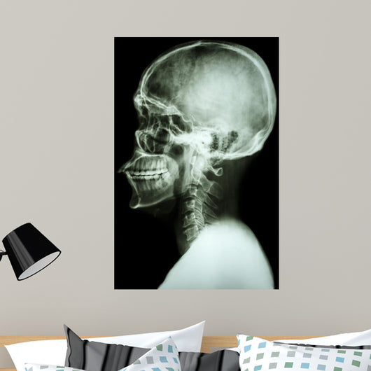 X-Ray Asian Skull and Cervical Spine 