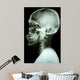 X-Ray Asian Skull and Cervical Spine 