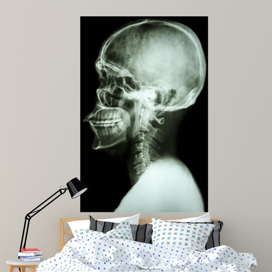 X-Ray Asian Skull and Cervical Spine 