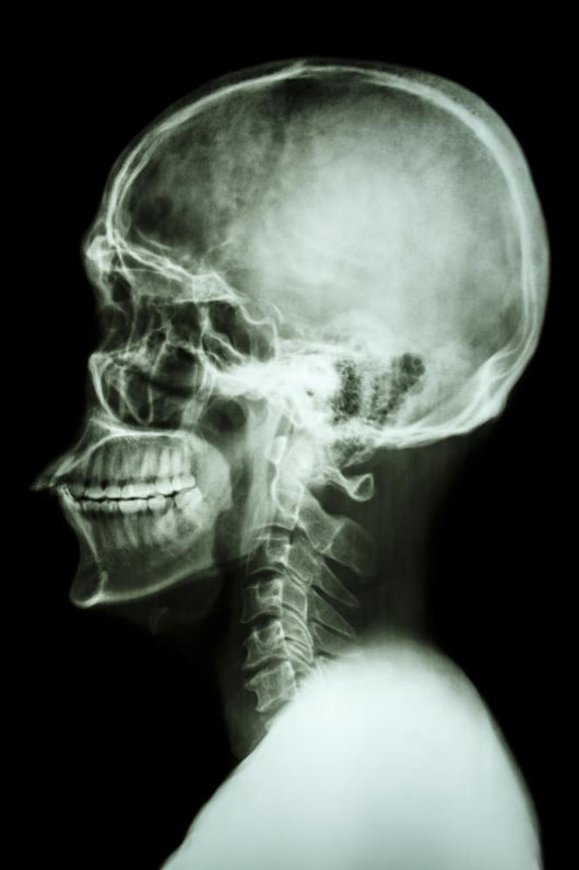 X-Ray Asian Skull and Cervical Spine 