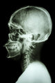 X-Ray Asian Skull and Cervical Spine 