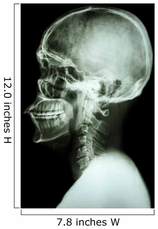X-Ray Asian Skull and Cervical Spine 