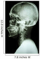 X-Ray Asian Skull and Cervical Spine 