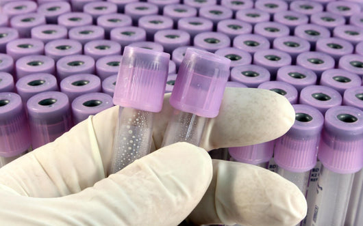researcher with rubber glove sorts research test tubes Wall Mural
