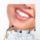 Laughing Woman Smile With Great Teeth Wall Decal